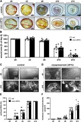 Short-term cryoprotectant-free cryopreservation at −20°C does not affect the viability and regenerative capacity of nanofat